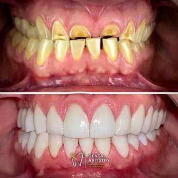 Slider image (7) Dental Artistry Dental Center